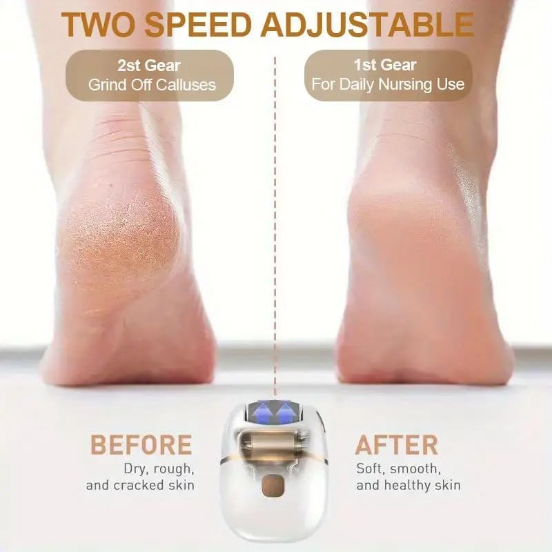 Electric Foot Callus Remover